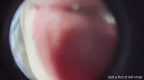 布鲁比呐呐_鱼眼镜头舔屏_布鲁比呐呐11-助眠云视听