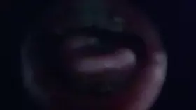 布鲁比呐呐_鱼眼镜头鱼眼镜头_3_1-助眠云视听