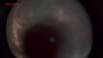 啵啵眠眠_10月限定鱼眼镜头酸奶甜屏-助眠云视听